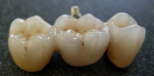 All On Four Dental Implants Long Island business image in Patchogue, NEW YORK